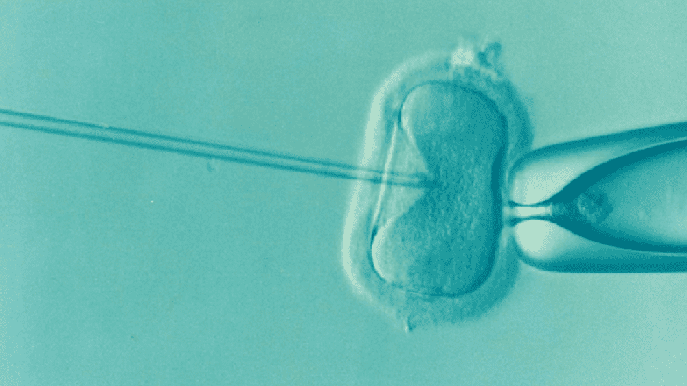 Fertility Treatment: An Embryonic Head Of Damages